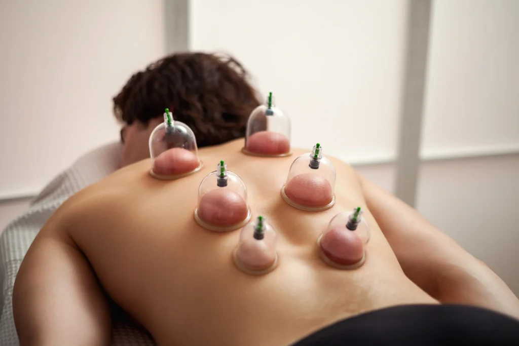 Cupping Massage